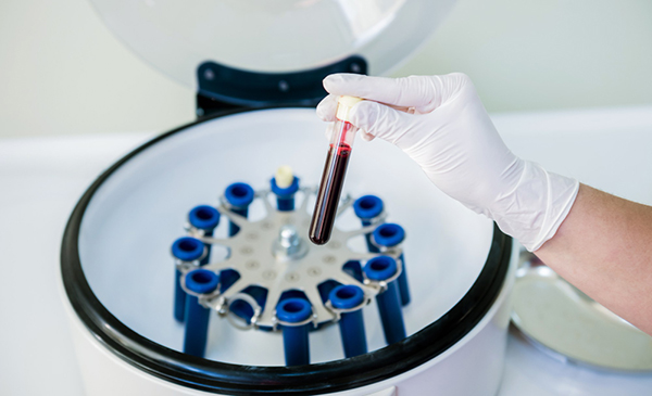 Основные показатели здоровья