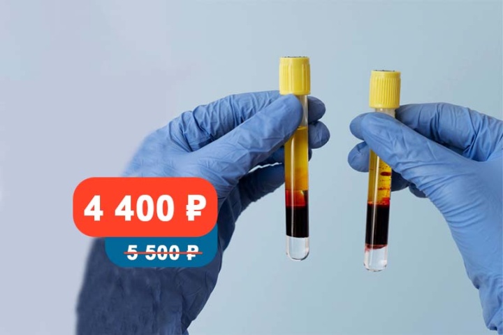 Аллергодиагностика со скидкой до 20%