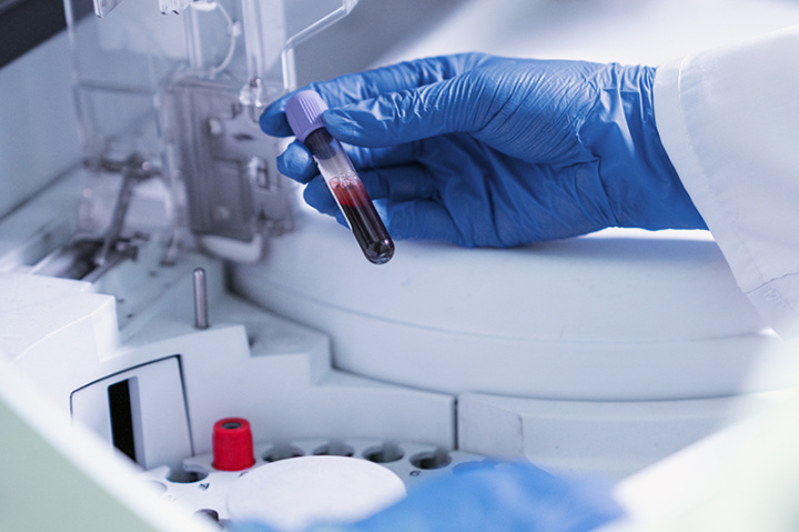 Биохимия крови — стандарт