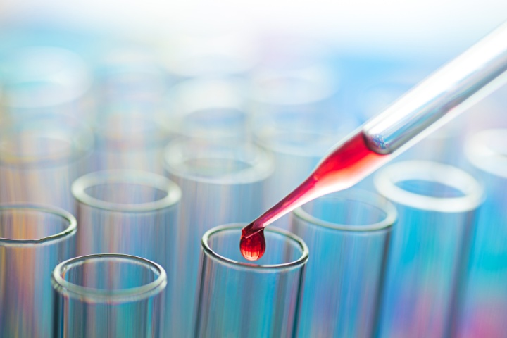 Биохимия крови скрининг