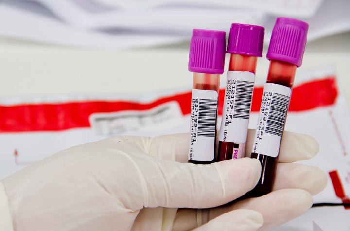 Биохимия крови — стандарт