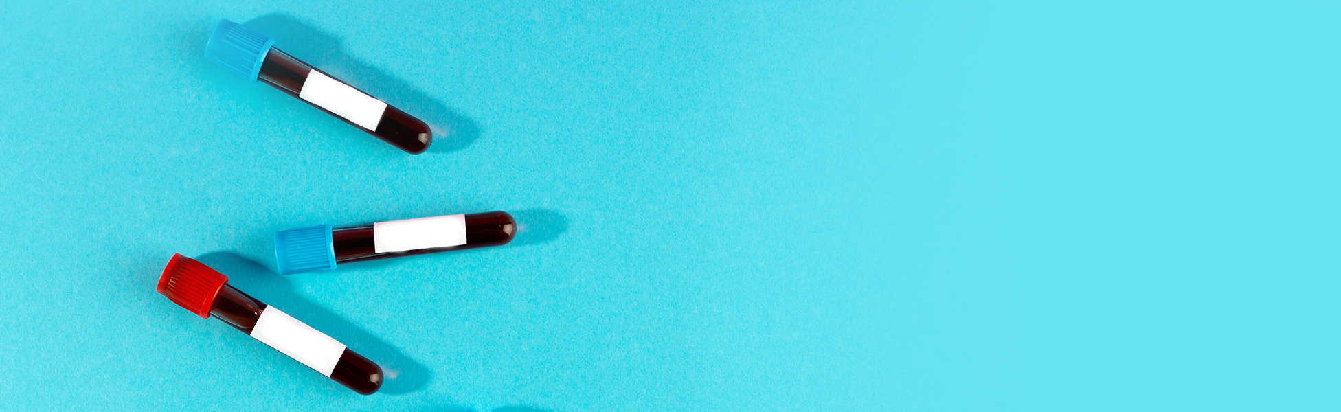 Изображение ОАК (с СОЭ и лейкоцитарной формулой) —  99 руб.