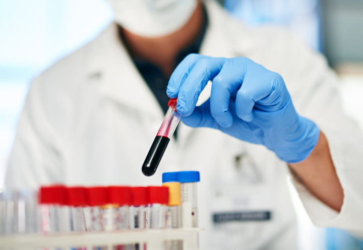 Биохимия крови — расширенный