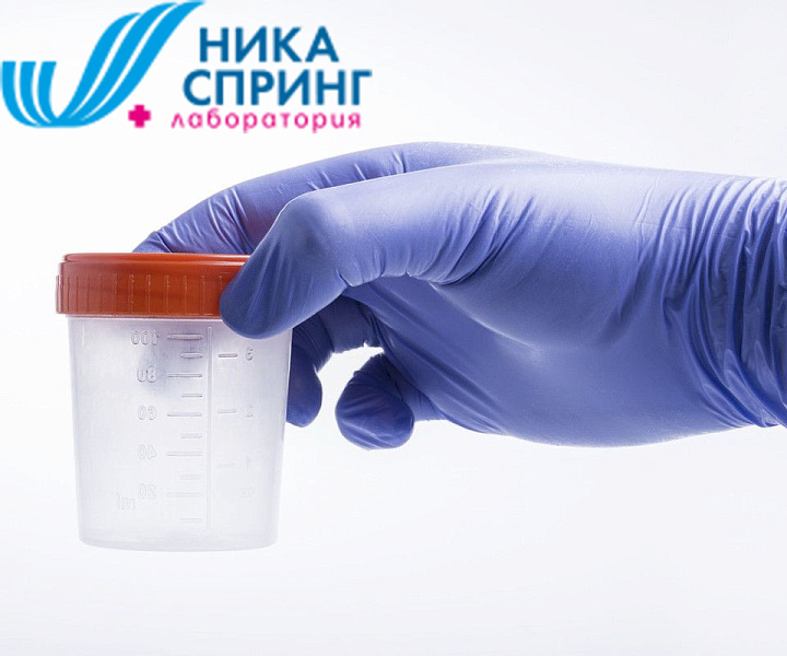 Изображение для категории Исследование мочи
